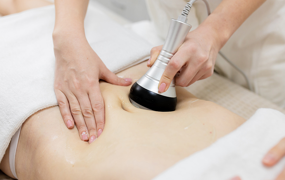 Technician performing non-surgical body contouring with radio frequency on a stomach.