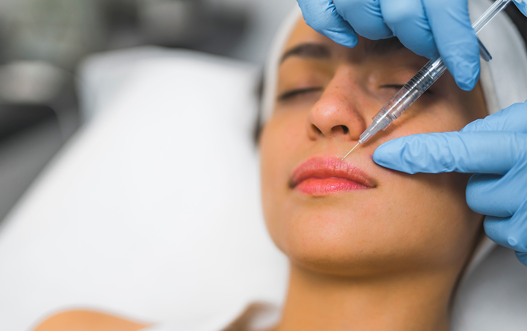 Woman lying down getting a Juvederm injection into the top of her lip for volume restoration and wrinkle smoothing.