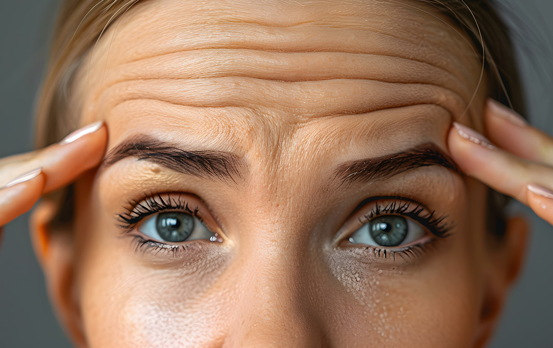 Close-up of a woman's forehead showing frown lines, highlighting the need for our fine lines and wrinkles facial treatment.