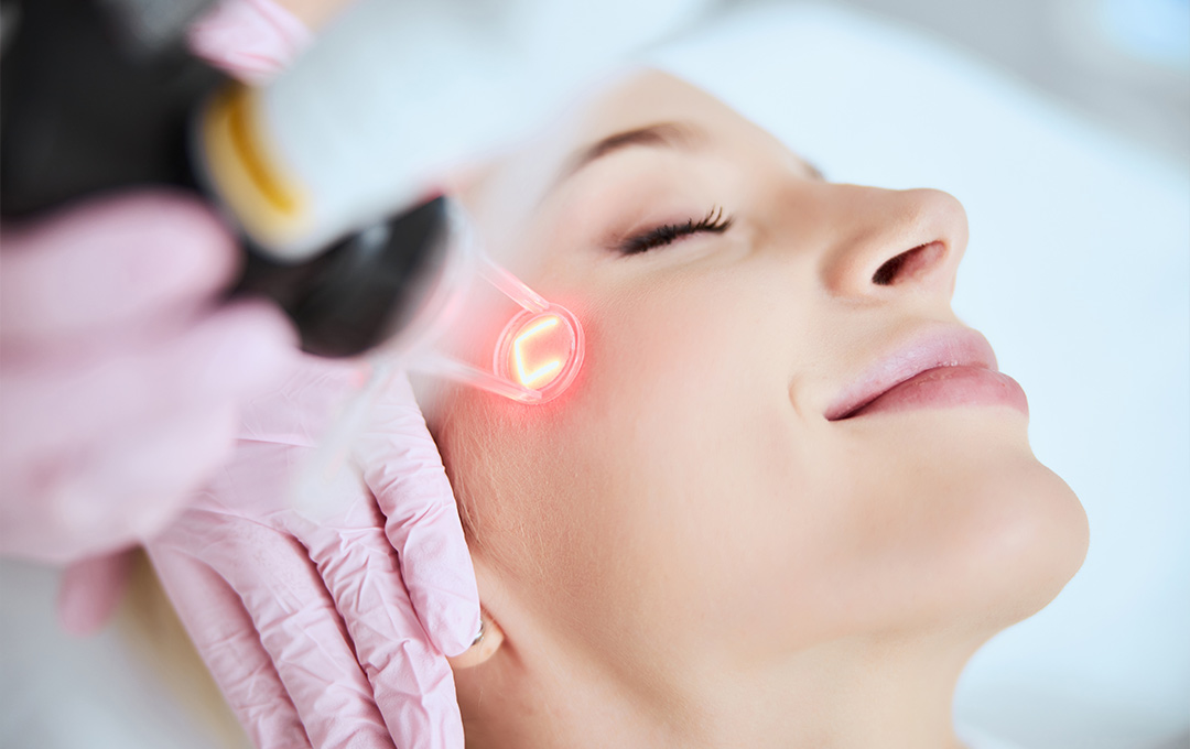 Woman lying back, smiling with her eyes closed, while a technician performs Laser Resurfacing.