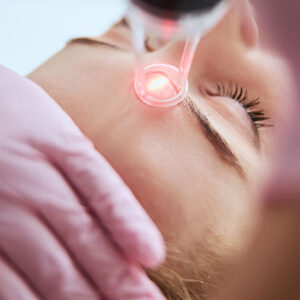 Caucasian female getting a laser skin treatment